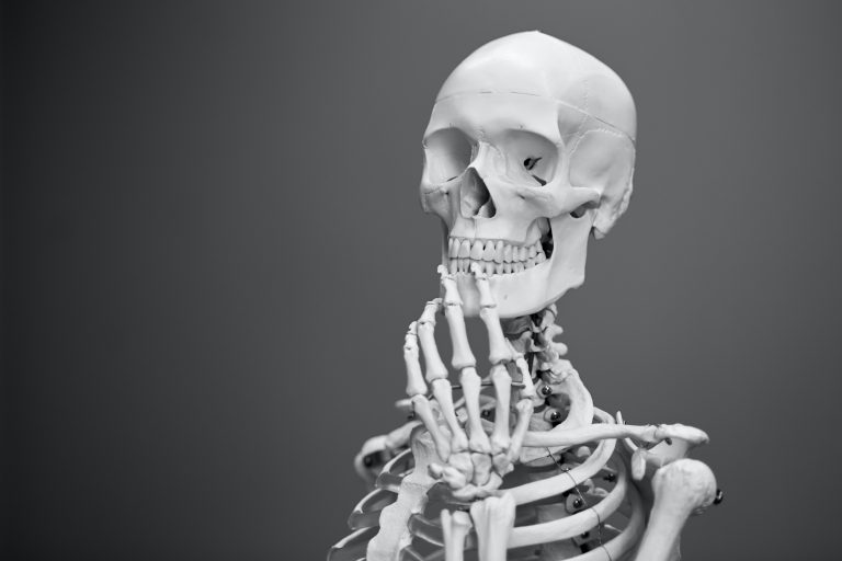 Skeletal of upper body in a thinking pose